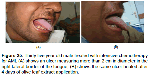 pharmaceutica-analytica-acta-lateral-border-tongue