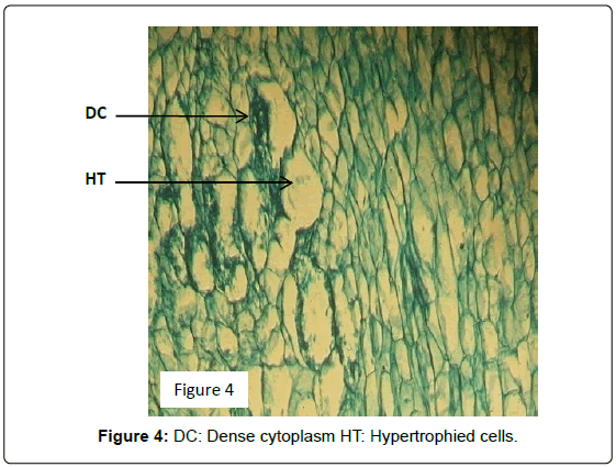 plant-pathology-microbiology-Dense-cytoplasm-Hypertrophied