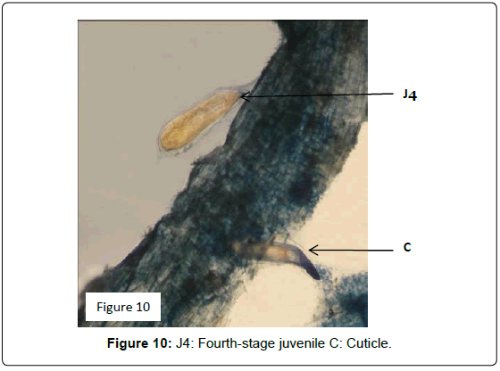 plant-pathology-microbiology-Fourth-stage-juvenile