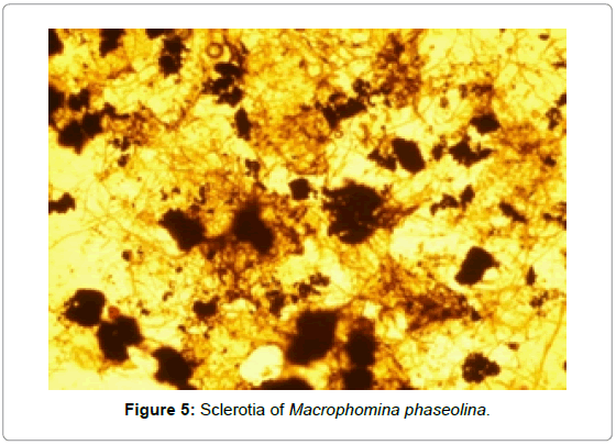 plant-pathology-microbiology-Sclerotia-Macrophomina-phaseolina