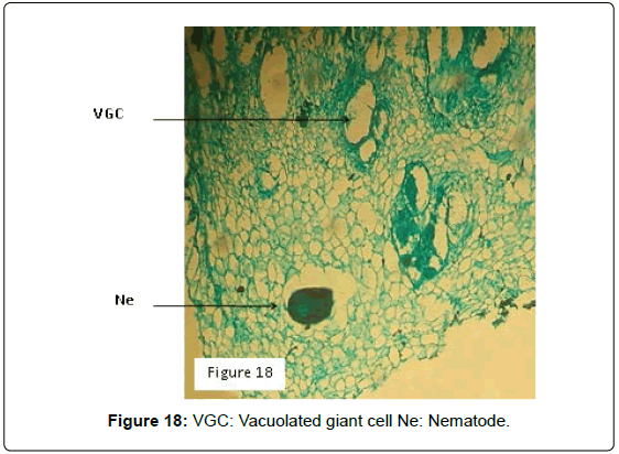 plant-pathology-microbiology-Vacuolated-giant-cell