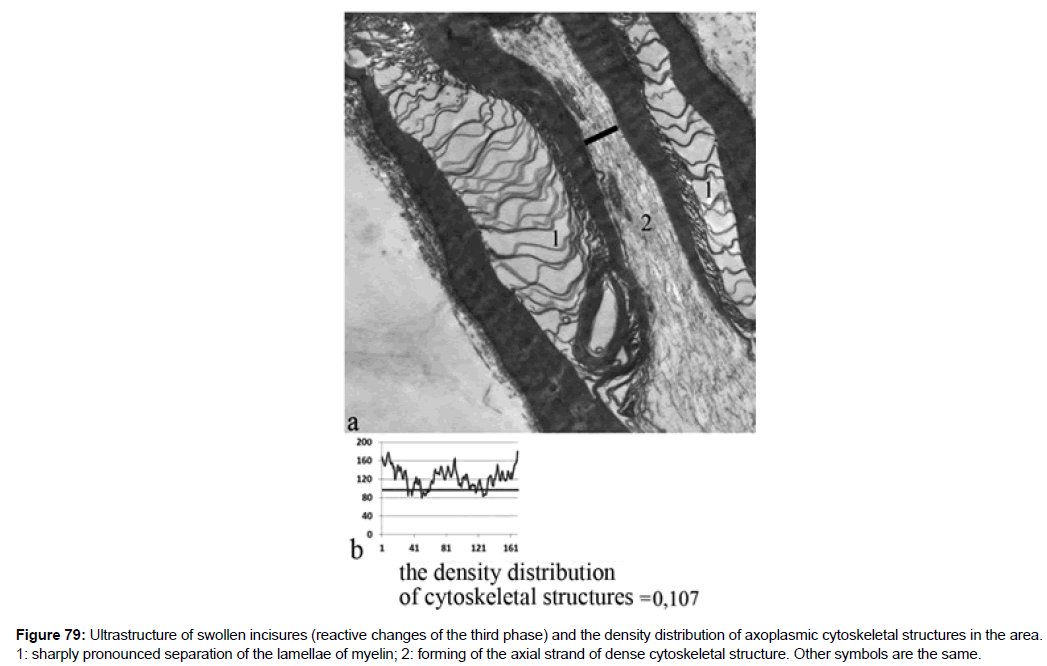 single-cell-biology-axoplasmic-cytoskeletal-structures