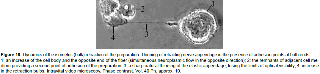 single-cell-biology-retracting-nerve-appendage