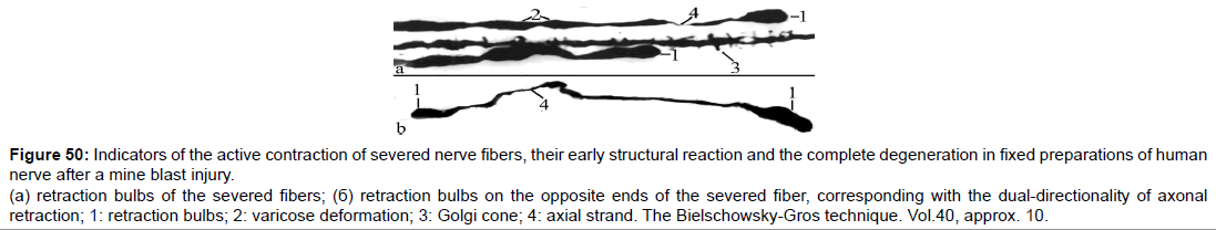 single-cell-biology-severed-nerve-fibers