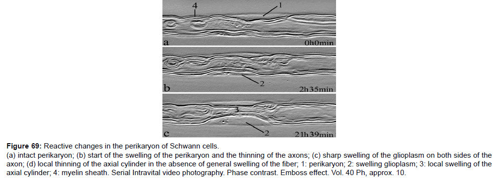 single-cell-biology-sharp-swelling-glioplasm