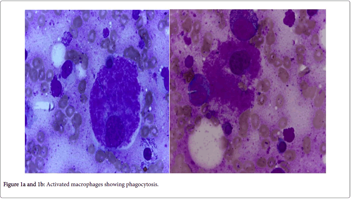 thrombosis-circulation-Activated-macrophages-phagocytosis