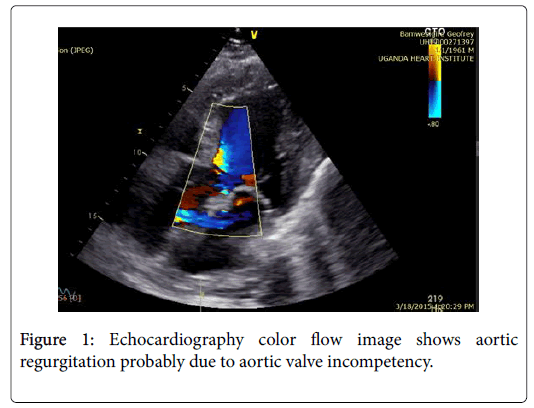 thrombosis-circulation-Echocardiography