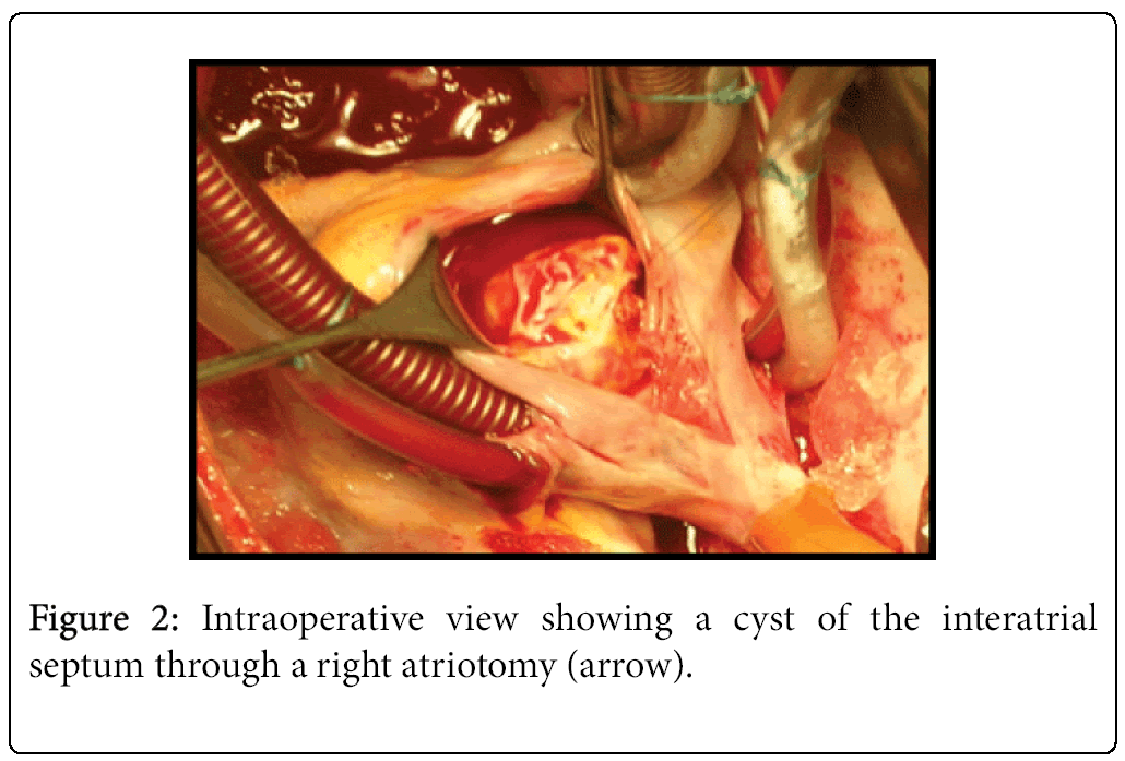 tropical-medicine-surgery-Intraoperative