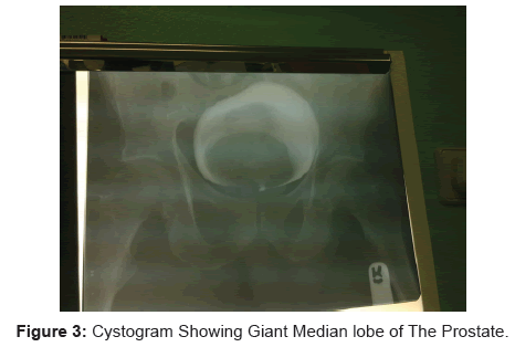 tropical-medicine-surgery-cystogram-giant-median