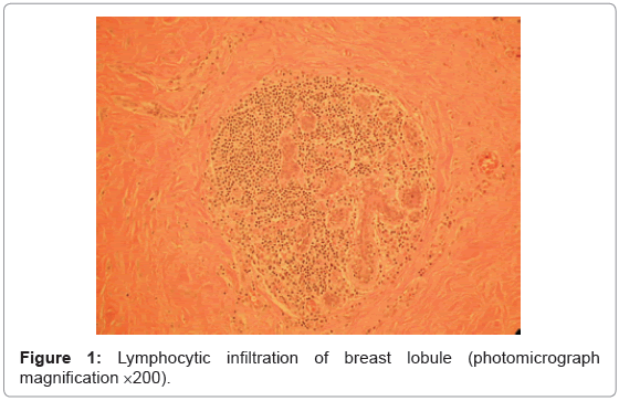 tropical-medicine-surgery-lymphocytic-infiltration-breast