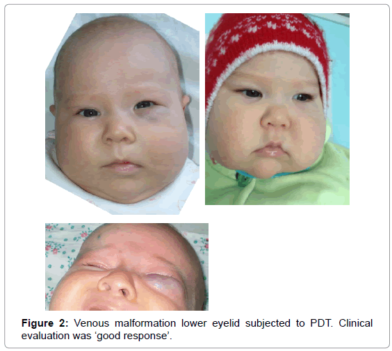 tropical-medicine-surgery-malformation-eyelid-clinical