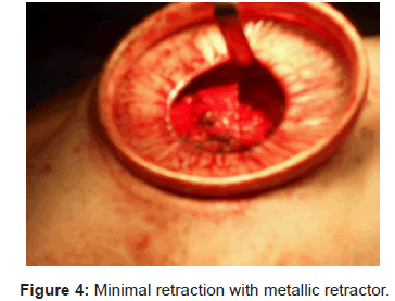 tropical-medicine-surgery-minimal-retraction-metallic