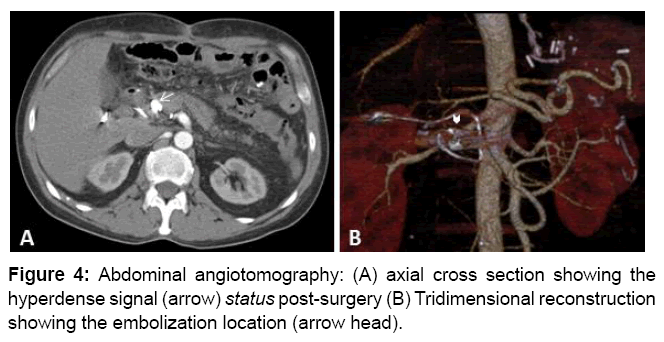 vascular-medicine-abdominal-angiotomography