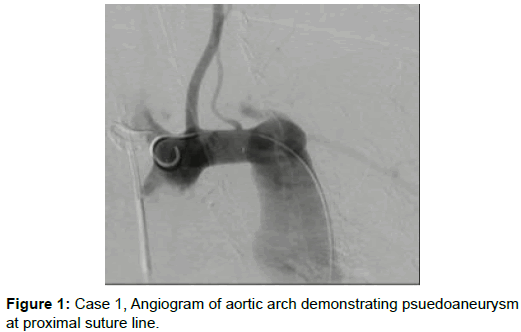 vascular-medicine-surgery-angiogram-aortic-arch