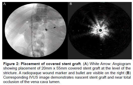 vascular-medicine-surgery-angiogram-stent-graft