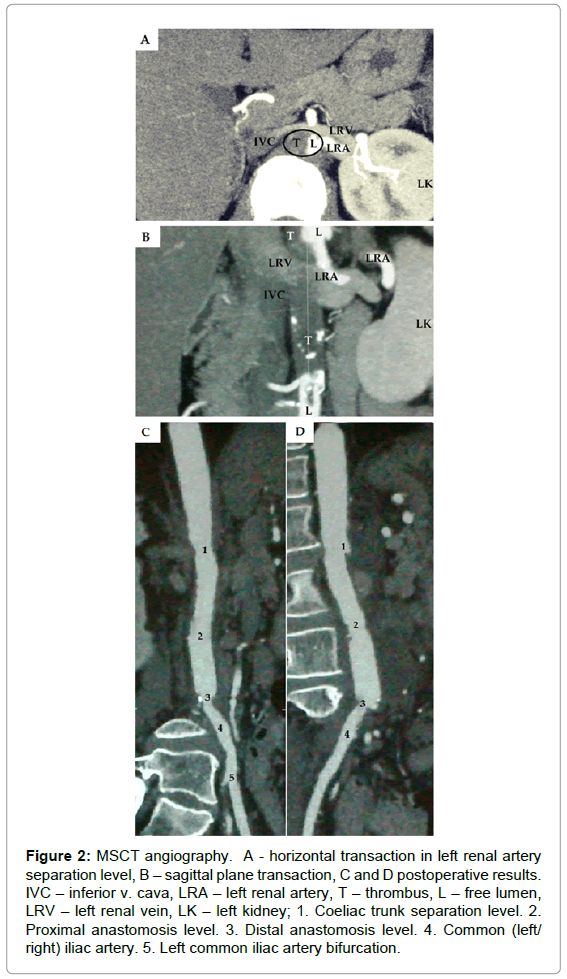vascular-medicine-surgery-angiography-horizontal-artery
