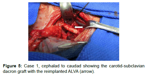 vascular-medicine-surgery-cephalad-caudad-carotid