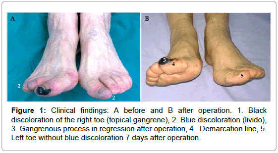 vascular-medicine-surgery-clinical-operation-discoloration
