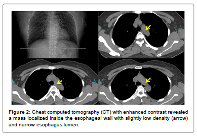 vascular-medicine-surgery-computed-tomography