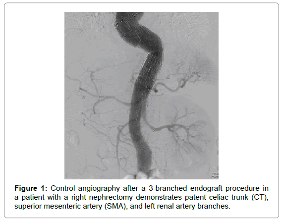 vascular-medicine-surgery-control-angiography-patient