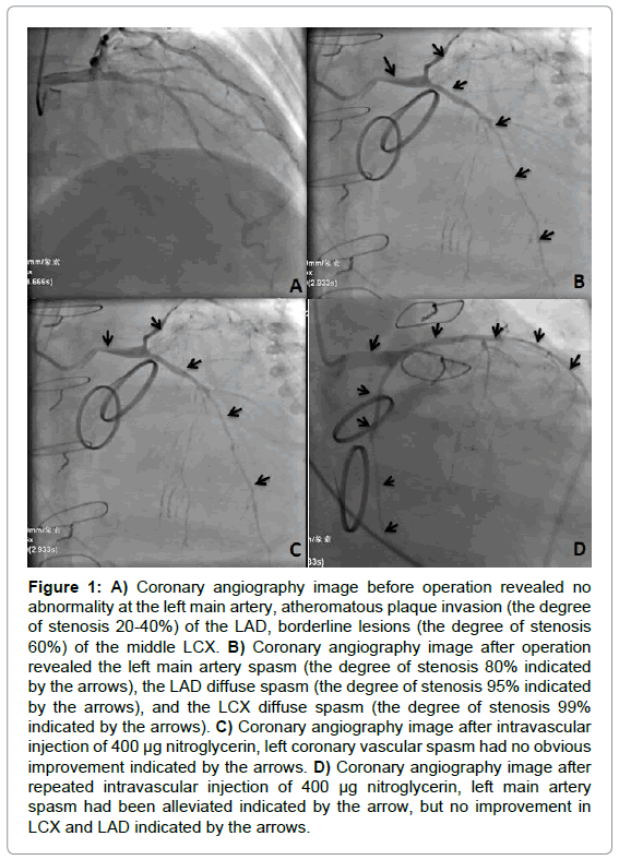 vascular-medicine-surgery-coronary-angiography-image