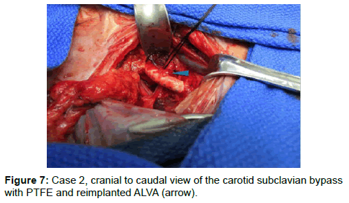 vascular-medicine-surgery-cranial-caudal-subclavian