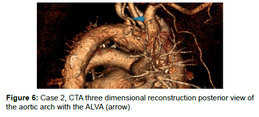 vascular-medicine-surgery-dimensional-posterior-aortic