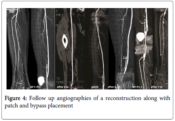 vascular-medicine-surgery-follow-up-angiographies
