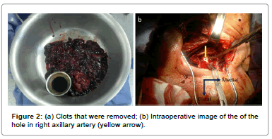 vascular-medicine-surgery-intraoperative-image