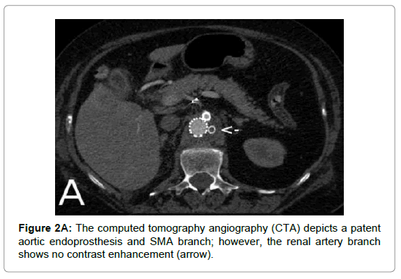 vascular-medicine-surgery-the-computed-tomography