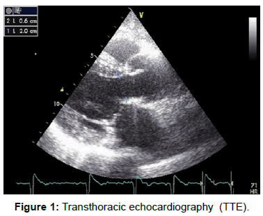 vascular-medicine-surgery-transthoracic-echocardiography